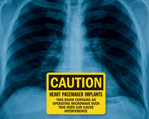 Pacemaker Warning Signs